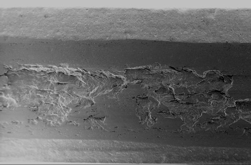 Gear Failure Analysis - Fretting